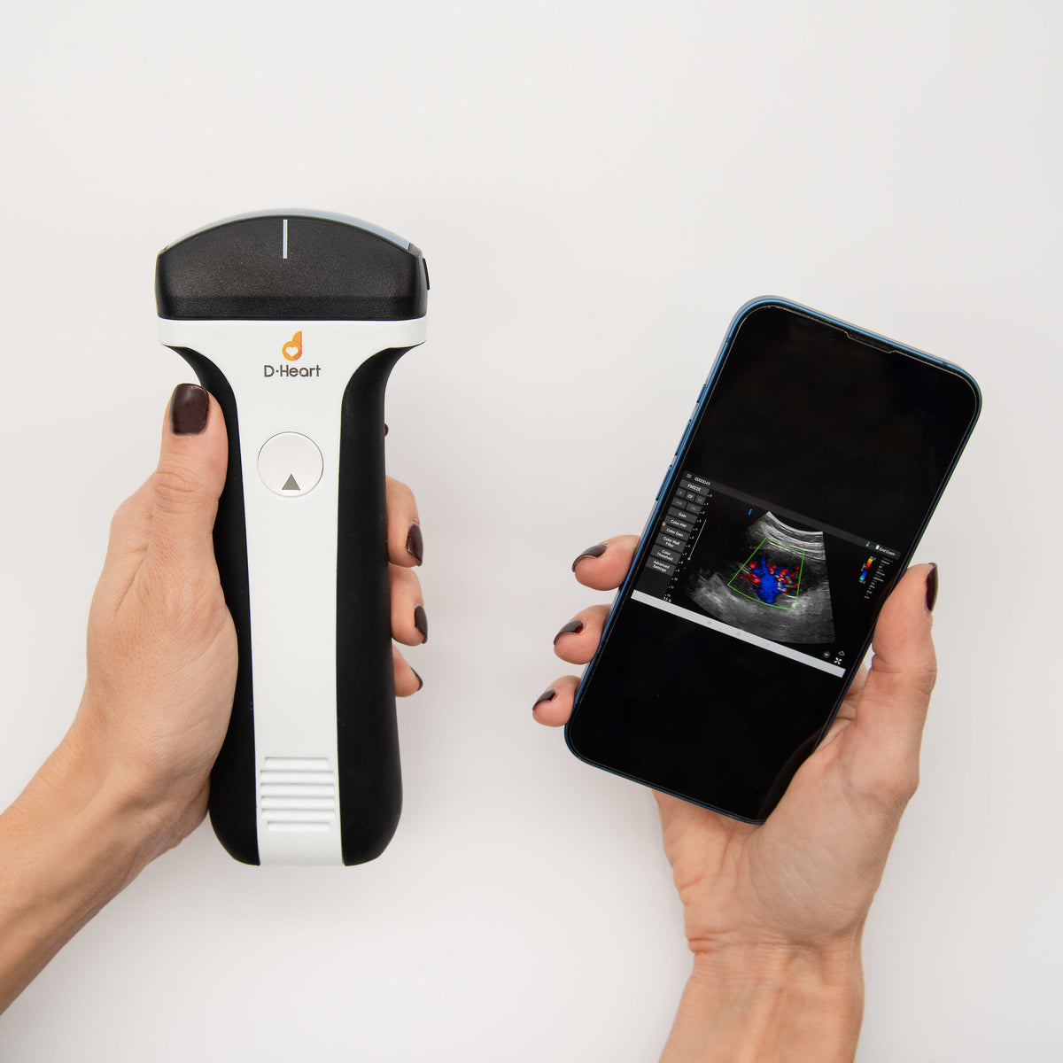 D-HEART SCANNER CONVEX