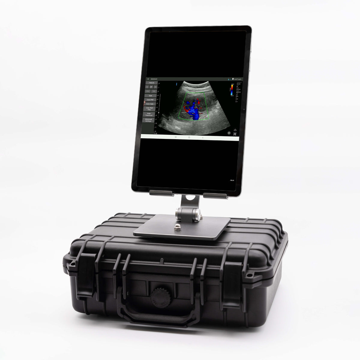 D-HEART SCANNER CONVEX