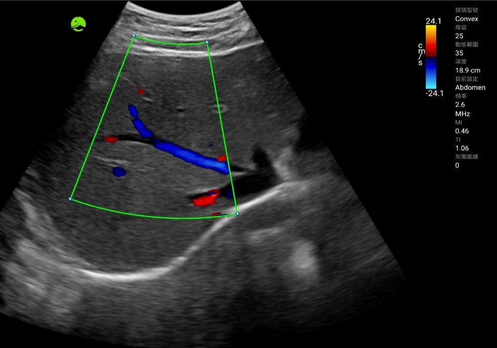 Abdominal — ultrasound image 2