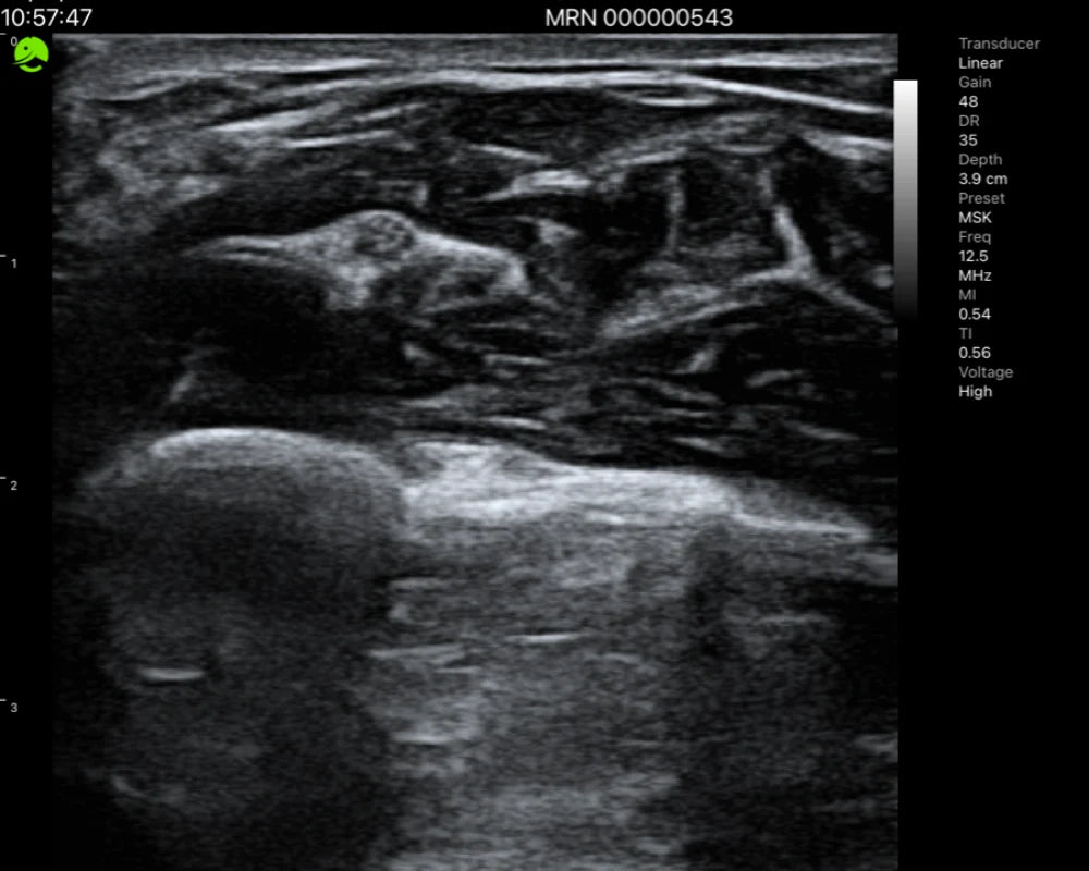Vascolare — immagine ecografica 2