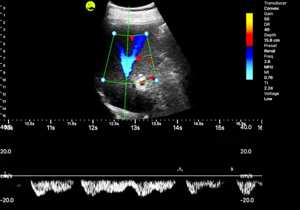 Abdominal — ultrasound image 1