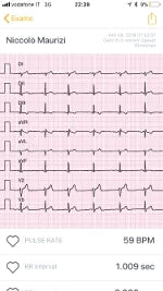 11. Remember to enter the information required for the tele report12. ...here’s your D-Heart Professional ECG