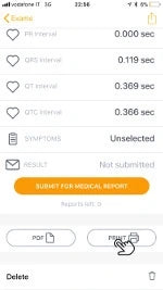 6. ... Scroll down and select print: you can have your D-Heart ECG on paper via Bluetooth!