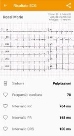 7. Here is the ECG assigned to your patient