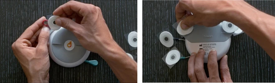 6. Connect the electrodes the D-Heart device