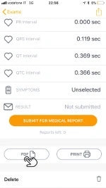 7. Tap on PDF if you would like to share your D-Heart ECG with your trusted cardiologist