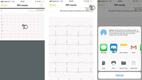 8. Share your D-Heart ECG with your trusted cardiologist