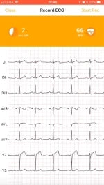 8. Record a professional D-Heart ECG
