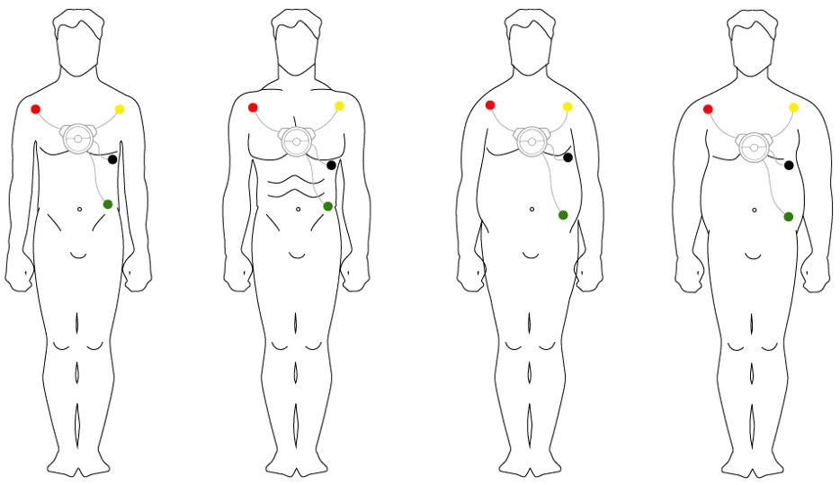 The app will guide you in the correct placement of the electrodes on the chest. You just need to follow the image with the electrodes already placed. And if you have difficulties...If you are a man...
