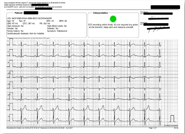 EXAMPLE OF 8 LEADS REPORT