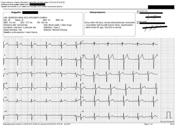 EXAMPLE OF 12 LEADS REPORT