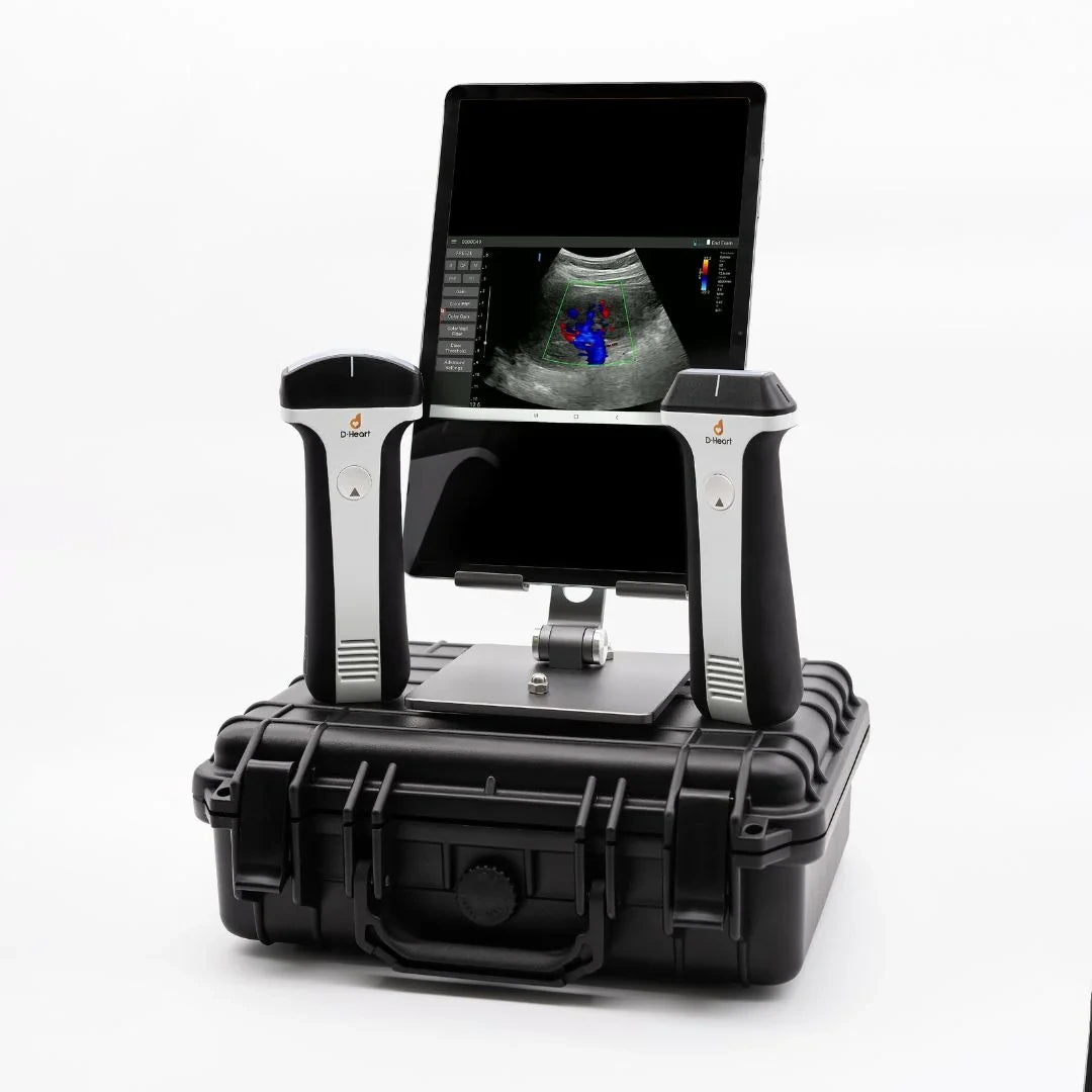 D-Heart ultrasound scanners — 1