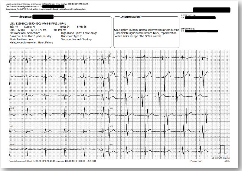 STANDARD REPORT (12-LEAD ECG)
