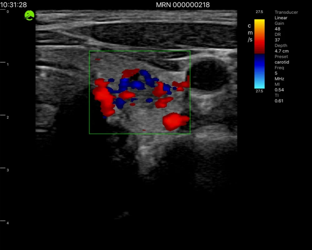 Vascular — ultrasound image 3