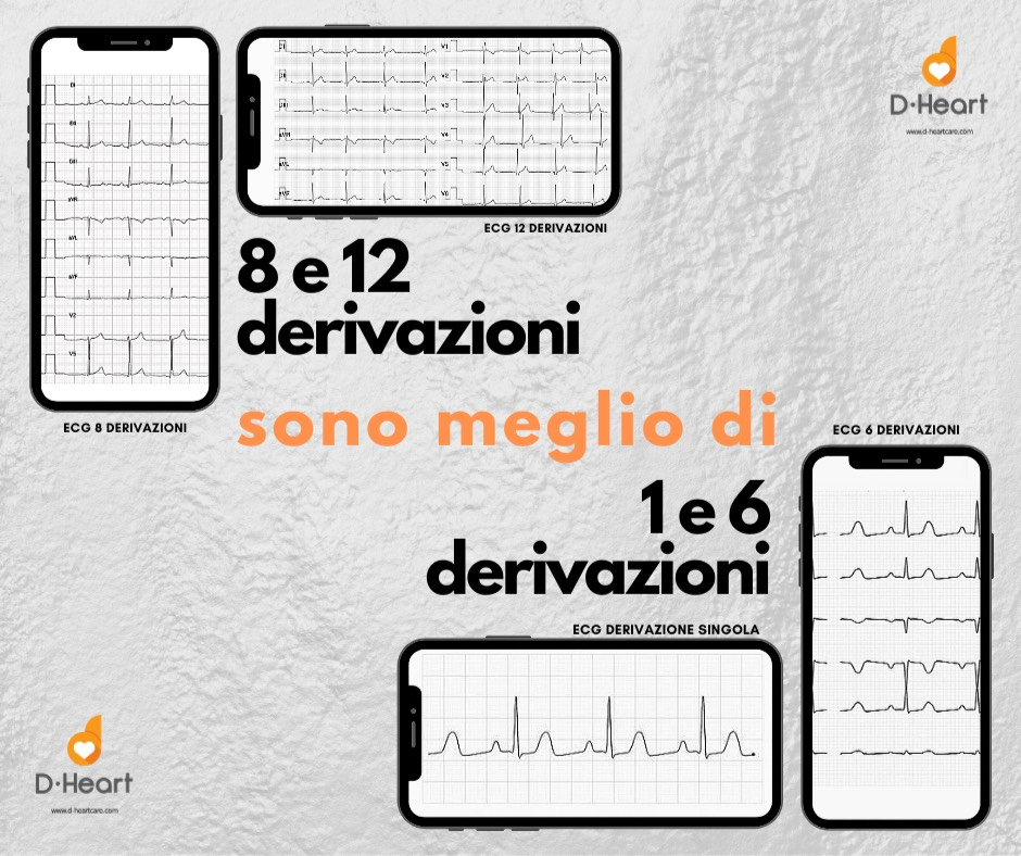 D-Heart 12-lead ECG